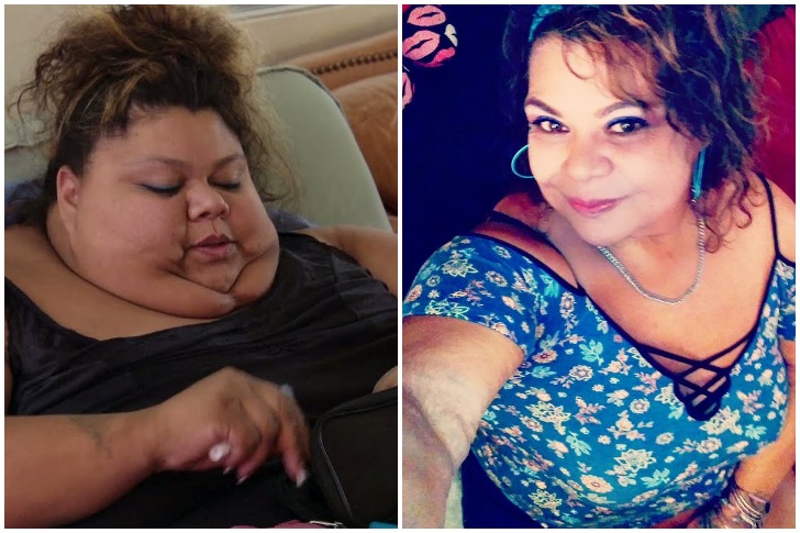 These People Have Lost An Extreme Amount Of Weight, They're Hardly The ...